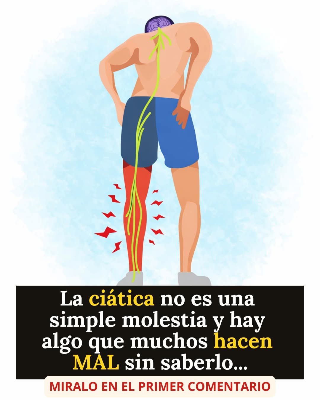 Cómo Acabar con el Dolor de Ciática: La Guía Completa para Aliviarlo… ver más