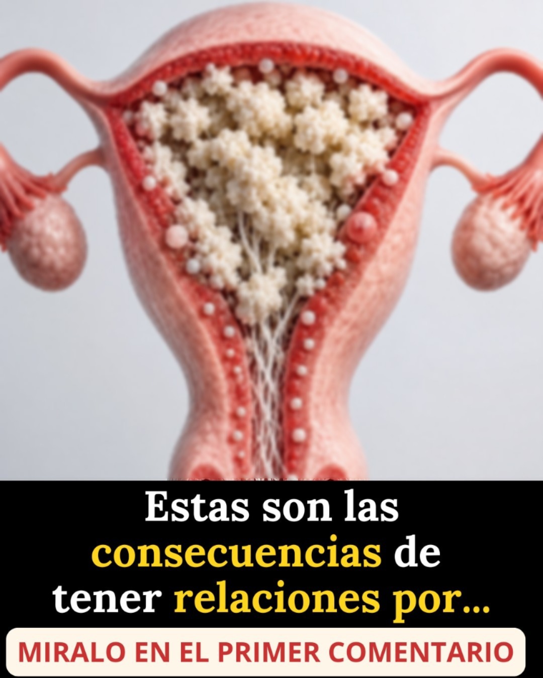 Estas son las consecuencias de tener relaciones por… Ver más