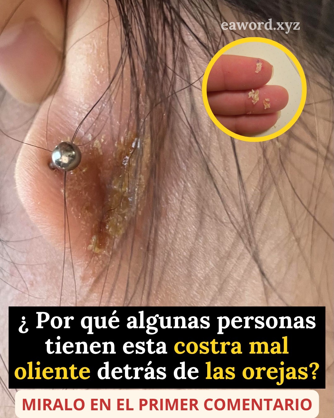 Si tienes costras detrás de las orejas significa sin duda que tienes…Ver Mas