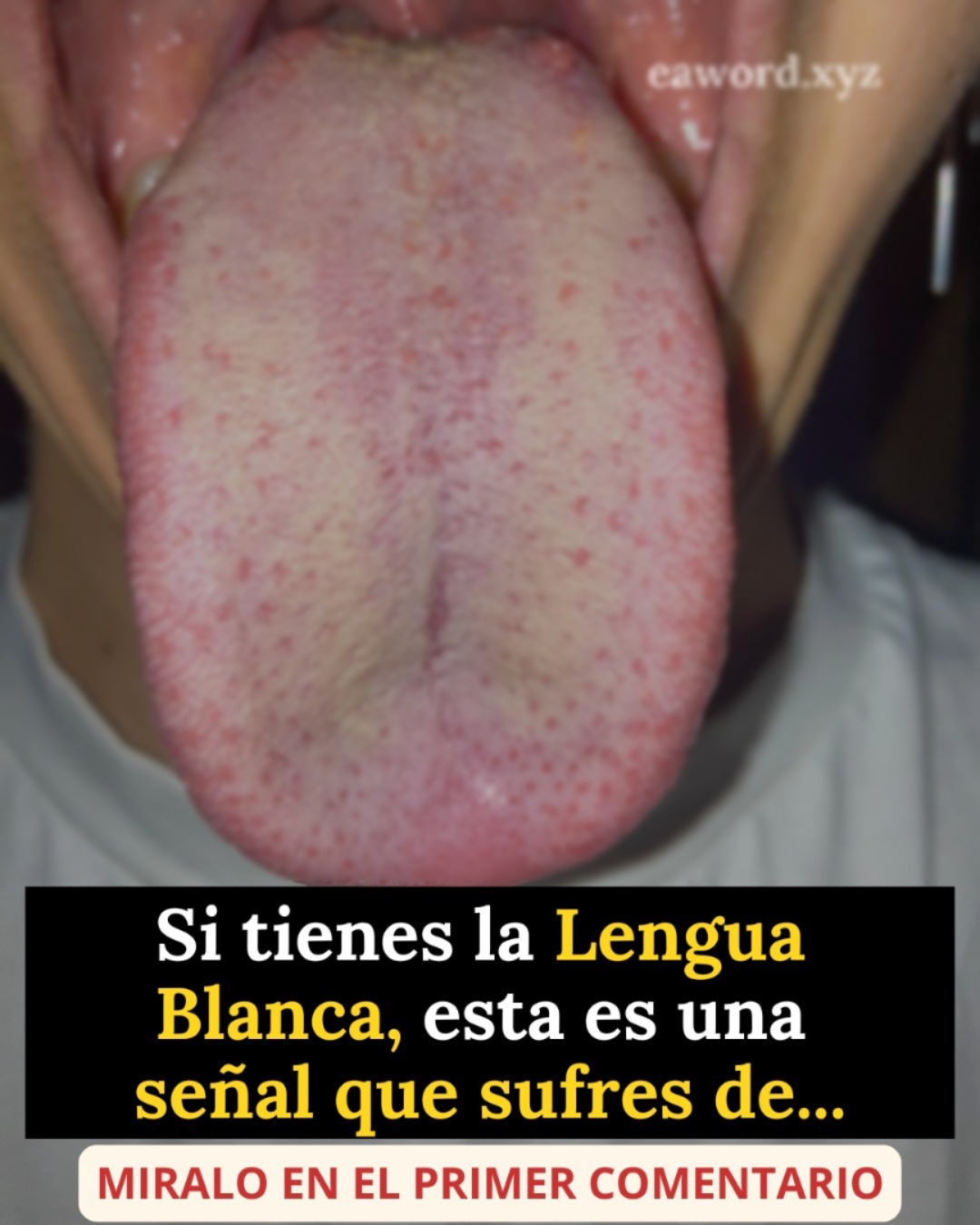 La persona que tiene la lengua blanca sin dudas tiene…Ver Mas