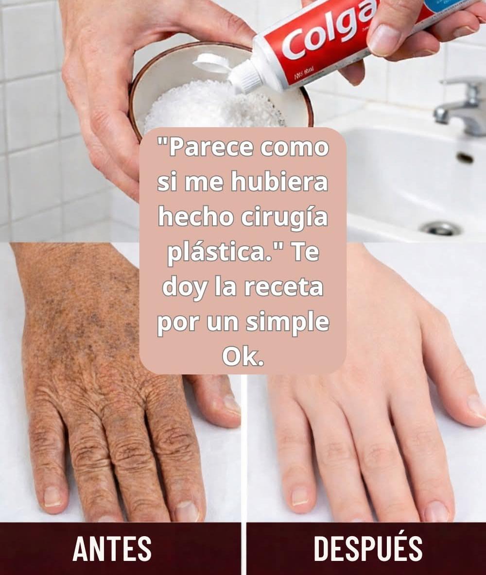 Parece que me hice una cirugía estética”: El remedio case..ver mas