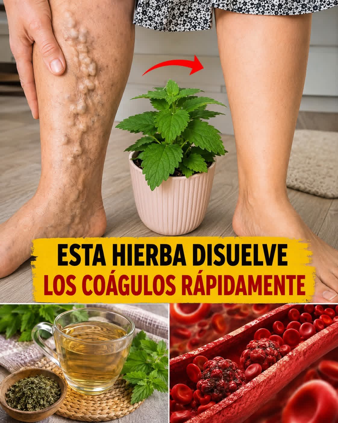 🛑 ¡ALERTA EN TUS PIERNAS! No ignores el dolor ni la hinchaz..ver mas