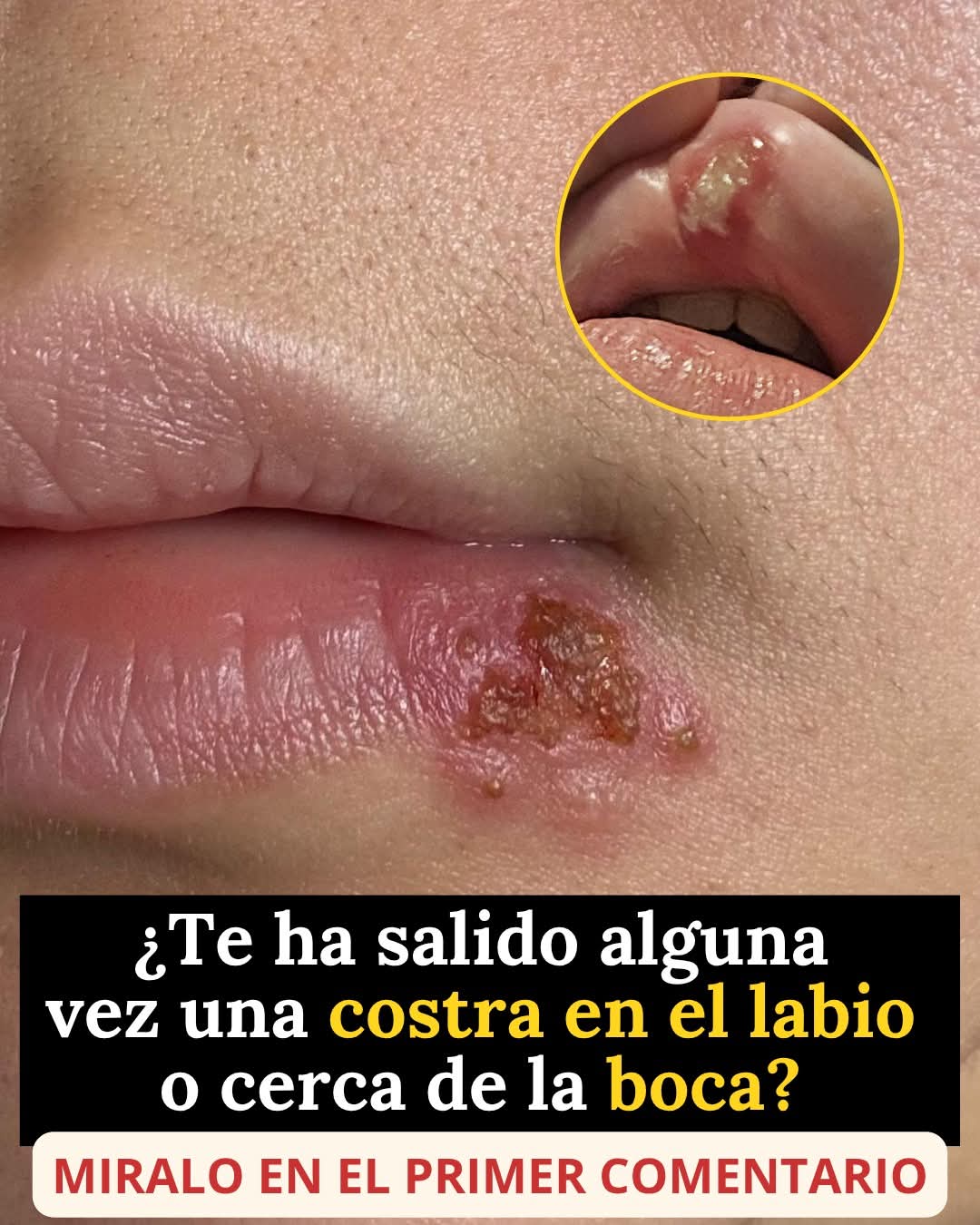 Estas se contagian cuando tienes se..Ver Mas