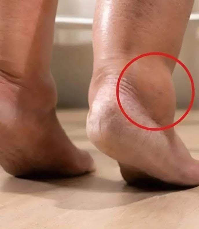 Sabias que los pies hinchados son por c…ver mas