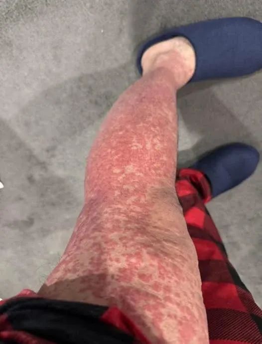 Estas son las consecuencias de dormir con… Ver más