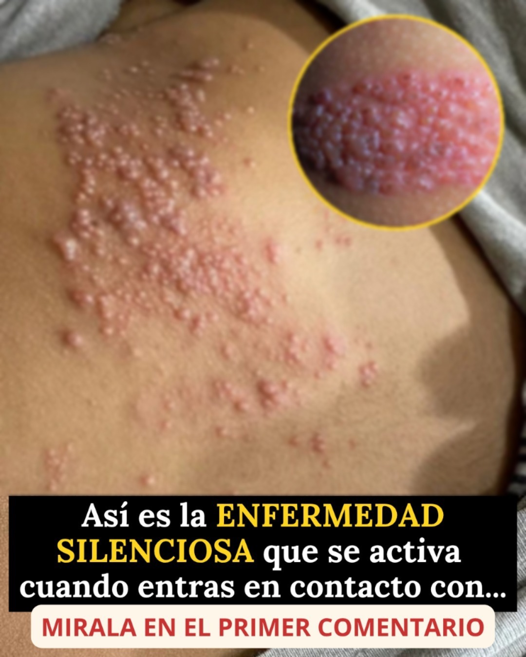 Así es la enfermedad que se activa cuando haces… Ver más