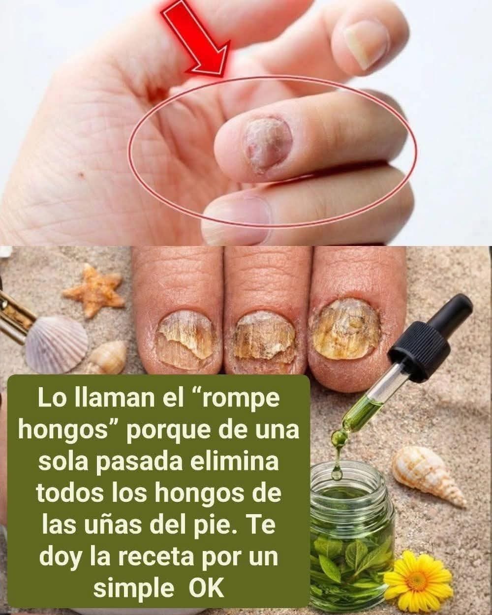Lo llaman el “rompe hongos” porque con una sola pasad..ver mas