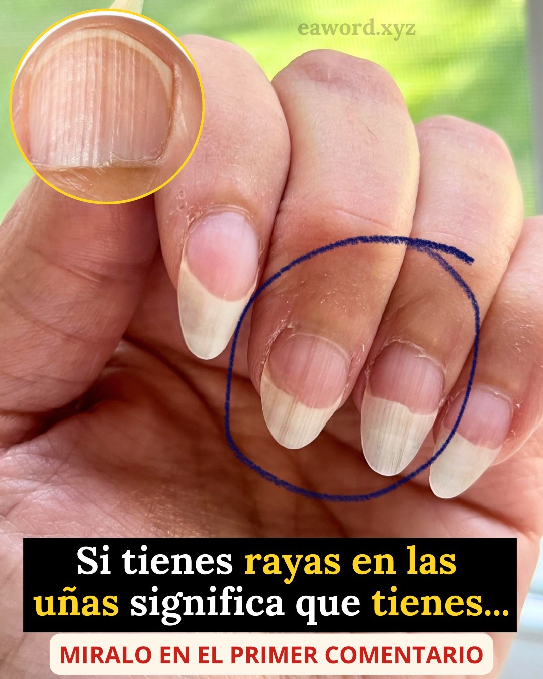 Si tienes rayas en tus uñas quiere decir que tienes… Ver más