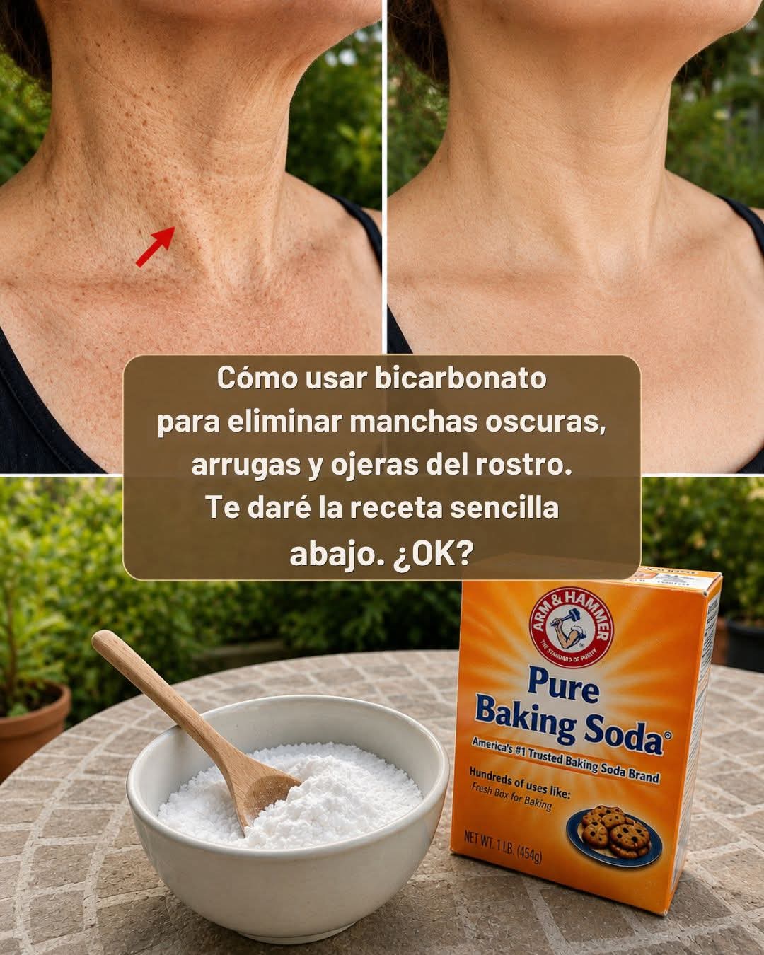 Cómo usar bicarbonato de sodio para eliminar manchas oscur..ver mas