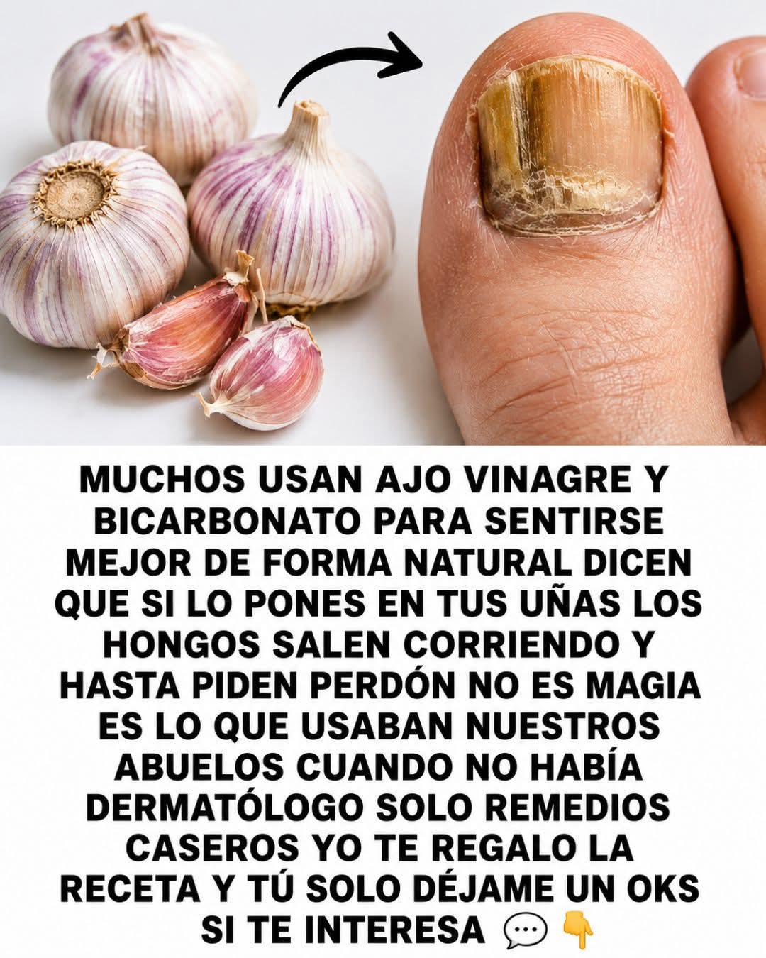 Si lo pones en tus uñas, los hongos salen corrien..ver mas