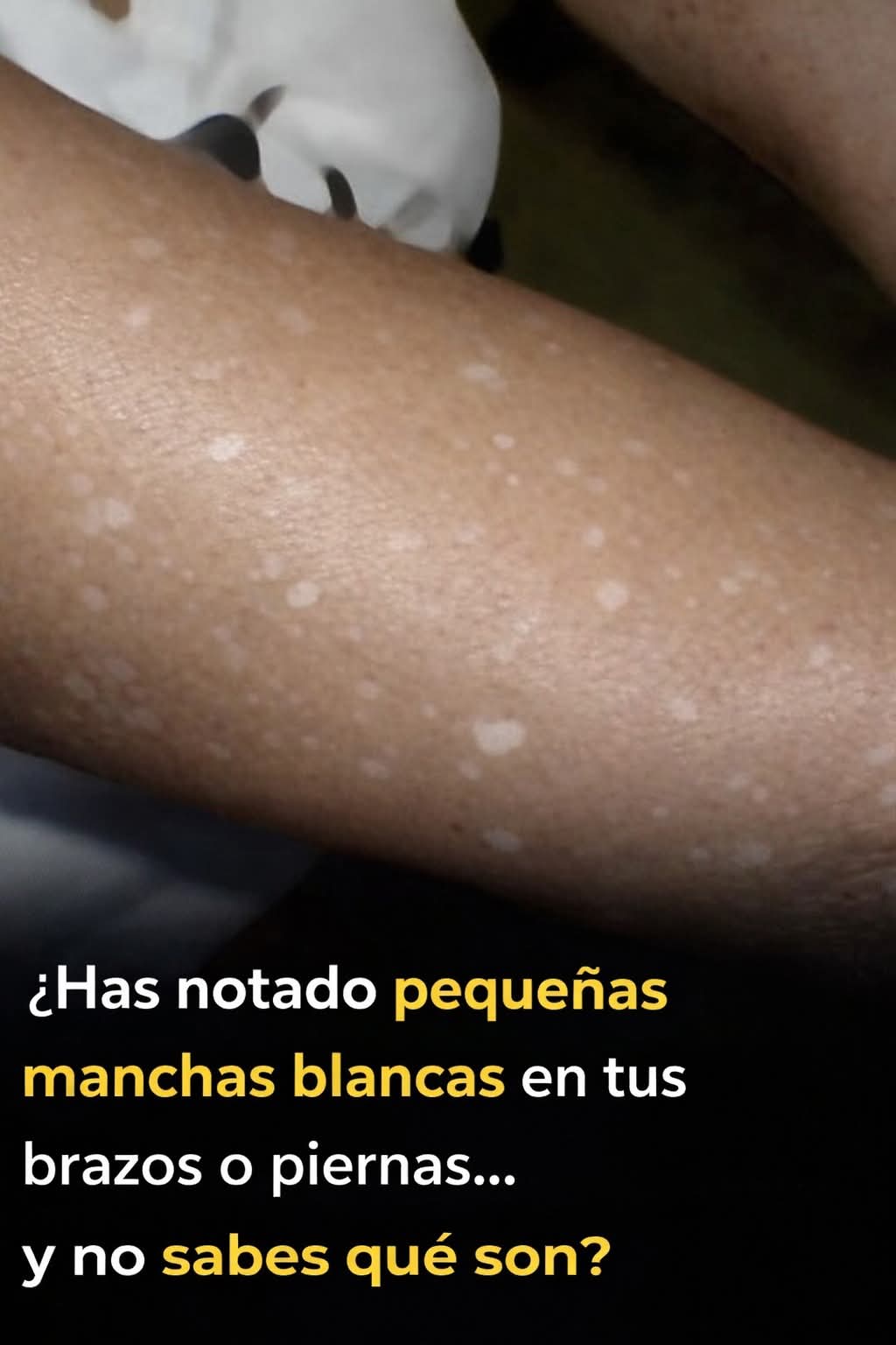 Pequeñas manchas blanc..ver mas