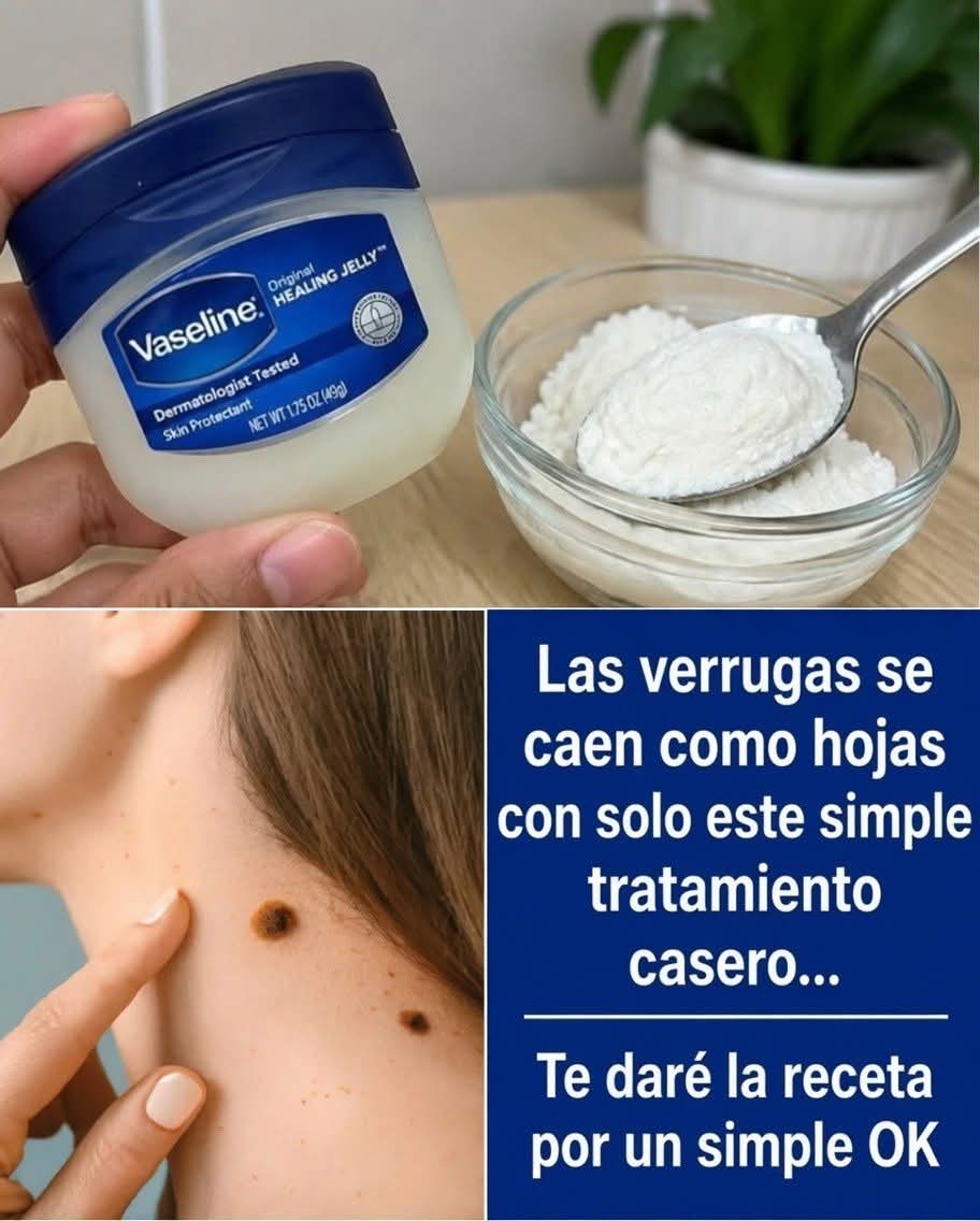 Las verrugas se caen como hojas con este sencillo tratamiento casero….Ver más